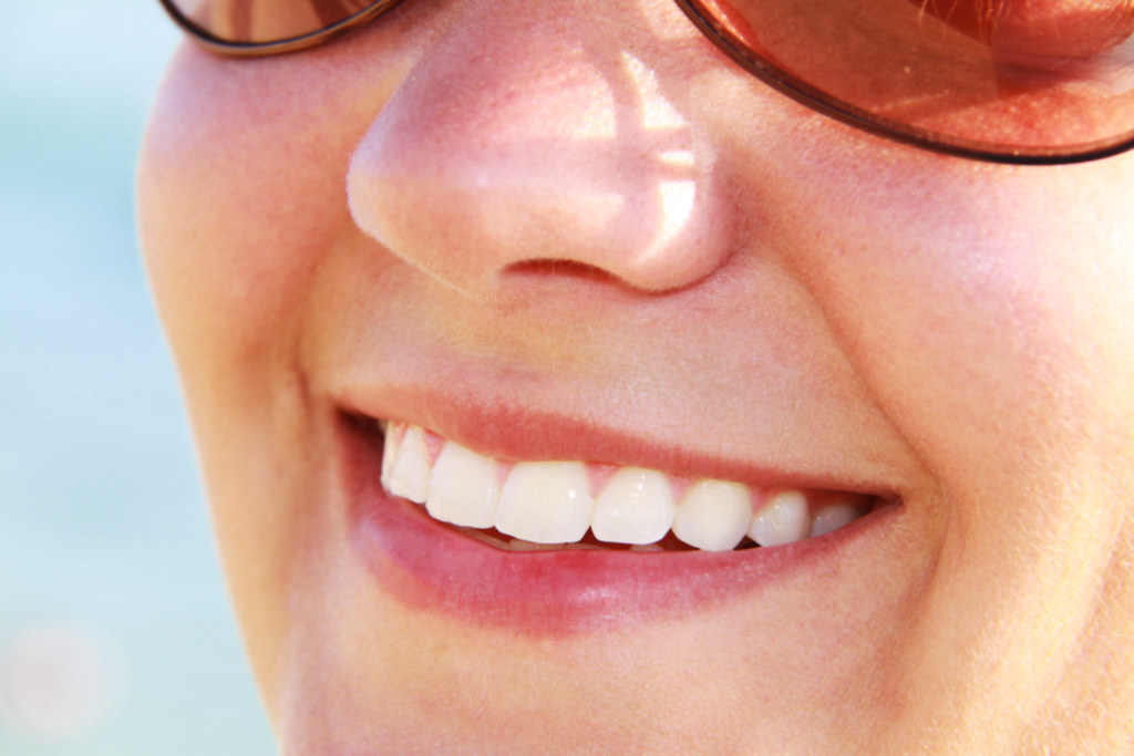 Sonrisa con dientes blancos, resultado de un tratamiento de blanqueamiento dental